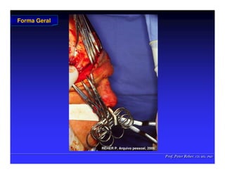 Prof. Peter Reher, CD, MSc, PhD
Prof. Peter Reher, CD, MSc, PhD
Forma Geral
Forma Geral
REHER P
REHER P.
. Arquivo
Arquivo pessoal
pessoal, 2006.
, 2006.
 