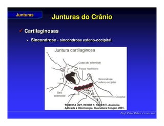 Prof. Peter Reher, CD, MSc, PhD
Prof. Peter Reher, CD, MSc, PhD
Junturas do Crânio
Junturas do Crânio
 Cartilaginosas
 Sincondrose - sincondrose esfeno-occipital

 Cartilaginosas
Cartilaginosas

 Sincondrose
Sincondrose -
- sincondrose
sincondrose esfeno
esfeno-
-occipital
occipital
Junturas
Junturas
TEIXEIRA LMT, REHER P, REHER V. Anatomia
TEIXEIRA LMT, REHER P, REHER V. Anatomia
Aplicada
Aplicada à
à Odontologia. Guanabara
Odontologia. Guanabara Koogan
Koogan, 2001
, 2001.
.
 