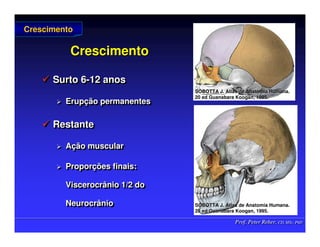 Prof. Peter Reher, CD, MSc, PhD
Prof. Peter Reher, CD, MSc, PhD
Crescimento
Crescimento
 Surto 6-12 anos
 Erupção permanentes
 Restante
 Ação muscular
 Proporções finais:
Viscerocrânio 1/2 do
Neurocrânio

 Surto 6
Surto 6-
-12 anos
12 anos

 Erup
Erupç
ção permanentes
ão permanentes

 Restante
Restante

 A
Aç
ção muscular
ão muscular

 Propor
Proporç
ções finais:
ões finais:
Viscerocrânio
Viscerocrânio 1/2 do
1/2 do
Neurocrânio
Neurocrânio
Crescimento
Crescimento
SOBOTTA J. Atlas de Anatomia Humana.
SOBOTTA J. Atlas de Anatomia Humana.
20 ed Guanabara
20 ed Guanabara Koogan
Koogan, 1995
, 1995.
.
SOBOTTA J. Atlas de Anatomia Humana.
SOBOTTA J. Atlas de Anatomia Humana.
20 ed Guanabara
20 ed Guanabara Koogan
Koogan, 1995
, 1995.
.
 