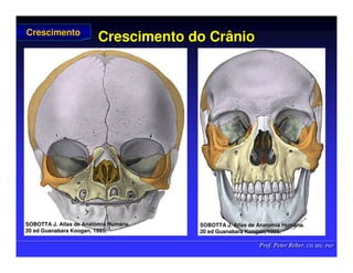 Prof. Peter Reher, CD, MSc, PhD
Prof. Peter Reher, CD, MSc, PhD
Crescimento do Crânio
Crescimento do Crânio
Crescimento
Crescimento
SOBOTTA J. Atlas de Anatomia Humana.
SOBOTTA J. Atlas de Anatomia Humana.
20 ed Guanabara
20 ed Guanabara Koogan
Koogan, 1995
, 1995.
.
SOBOTTA J. Atlas de Anatomia Humana.
SOBOTTA J. Atlas de Anatomia Humana.
20 ed Guanabara
20 ed Guanabara Koogan
Koogan, 1995
, 1995.
.
 