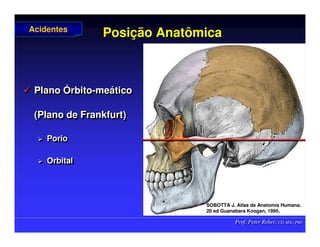 Prof. Peter Reher, CD, MSc, PhD
Prof. Peter Reher, CD, MSc, PhD
Posi
Posiç
ção Anatômica
ão Anatômica
 Plano Órbito-meático
(Plano de Frankfurt)
 Porio
 Orbital

 Plano
Plano Ó
Órbito
rbito-
-me
meá
ático
tico
(Plano de Frankfurt)
(Plano de Frankfurt)

 Porio
Porio

 Orbital
Orbital
Acidentes
Acidentes
SOBOTTA J. Atlas de Anatomia Humana.
SOBOTTA J. Atlas de Anatomia Humana.
20 ed Guanabara
20 ed Guanabara Koogan
Koogan, 1995
, 1995.
.
 