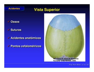 Prof. Peter Reher, CD, MSc, PhD
Prof. Peter Reher, CD, MSc, PhD
Vista Superior
Vista Superior
 Ossos
 Suturas
 Acidentes anatômicos
 Pontos cefalométricos

 Ossos
Ossos

 Suturas
Suturas

 Acidentes anatômicos
Acidentes anatômicos

 Pontos
Pontos cefalom
cefalomé
étricos
tricos
Acidentes
Acidentes
NETTER F H. Atlas de Anatomia
NETTER F H. Atlas de Anatomia
Humana.
Humana. 2 ed,
2 ed, Artmed
Artmed, 2000.
, 2000.
 