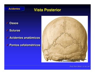 Prof. Peter Reher, CD, MSc, PhD
Prof. Peter Reher, CD, MSc, PhD
Vista Posterior
Vista Posterior
 Ossos
 Suturas
 Acidentes anatômicos
 Pontos cefalométricos

 Ossos
Ossos

 Suturas
Suturas

 Acidentes anatômicos
Acidentes anatômicos

 Pontos
Pontos cefalom
cefalomé
étricos
tricos
Acidentes
Acidentes
SOBOTTA J. Atlas de Anatomia Humana.
SOBOTTA J. Atlas de Anatomia Humana.
20 ed Guanabara
20 ed Guanabara Koogan
Koogan, 1995
, 1995.
.
 