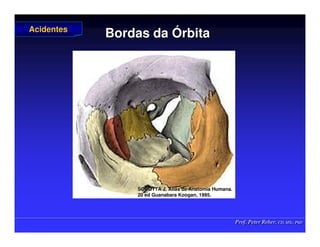 Prof. Peter Reher, CD, MSc, PhD
Prof. Peter Reher, CD, MSc, PhD
Bordas da
Bordas da Ó
Órbita
rbita
Acidentes
Acidentes
SOBOTTA J. Atlas de Anatomia Humana.
SOBOTTA J. Atlas de Anatomia Humana.
20 ed Guanabara
20 ed Guanabara Koogan
Koogan, 1995
, 1995.
.
 