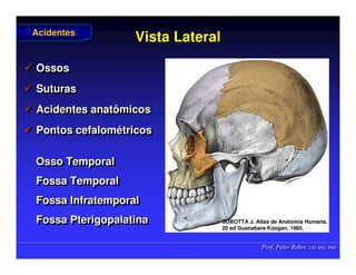 Prof. Peter Reher, CD, MSc, PhD
Prof. Peter Reher, CD, MSc, PhD
Vista Lateral
Vista Lateral
 Ossos
 Suturas
 Acidentes anatômicos
 Pontos cefalométricos

 Ossos
Ossos

 Suturas
Suturas

 Acidentes anatômicos
Acidentes anatômicos

 Pontos
Pontos cefalom
cefalomé
étricos
tricos
Osso Temporal
Fossa Temporal
Fossa Infratemporal
Fossa Pterigopalatina
Osso Temporal
Osso Temporal
Fossa Temporal
Fossa Temporal
Fossa
Fossa Infratemporal
Infratemporal
Fossa Pterigopalatina
Fossa Pterigopalatina
Acidentes
Acidentes
SOBOTTA J. Atlas de Anatomia Humana.
SOBOTTA J. Atlas de Anatomia Humana.
20 ed Guanabara
20 ed Guanabara Koogan
Koogan, 1995
, 1995.
.
 