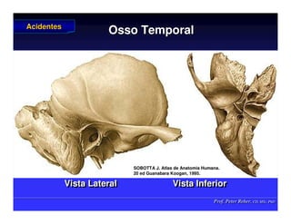 Prof. Peter Reher, CD, MSc, PhD
Prof. Peter Reher, CD, MSc, PhD
Osso Temporal
Osso Temporal
Vista Lateral Vista Inferior
Vista Lateral Vista Inferior
Acidentes
Acidentes
SOBOTTA J. Atlas de Anatomia Humana.
SOBOTTA J. Atlas de Anatomia Humana.
20 ed Guanabara
20 ed Guanabara Koogan
Koogan, 1995
, 1995.
.
 