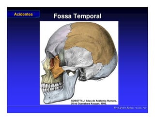 Prof. Peter Reher, CD, MSc, PhD
Prof. Peter Reher, CD, MSc, PhD
Fossa Temporal
Fossa Temporal
Acidentes
Acidentes
SOBOTTA J. Atlas de Anatomia Humana.
SOBOTTA J. Atlas de Anatomia Humana.
20 ed Guanabara
20 ed Guanabara Koogan
Koogan, 1995
, 1995.
.
 