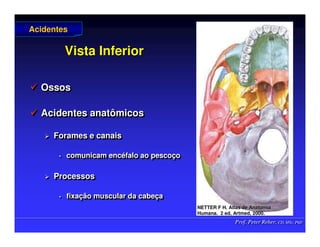 Prof. Peter Reher, CD, MSc, PhD
Prof. Peter Reher, CD, MSc, PhD
Vista Inferior
Vista Inferior
 Ossos
 Acidentes anatômicos
 Forames e canais
• comunicam encéfalo ao pescoço
 Processos
• fixação muscular da cabeça

 Ossos
Ossos

 Acidentes anatômicos
Acidentes anatômicos

 Forames e canais
Forames e canais
•
• comunicam enc
comunicam encé
éfalo ao pesco
falo ao pescoç
ço
o

 Processos
Processos
•
• fixa
fixaç
ção muscular da cabe
ão muscular da cabeç
ça
a
Acidentes
Acidentes
NETTER F H. Atlas de Anatomia
NETTER F H. Atlas de Anatomia
Humana.
Humana. 2 ed,
2 ed, Artmed
Artmed, 2000.
, 2000.
 