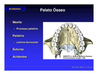 Prof. Peter Reher, CD, MSc, PhD
Prof. Peter Reher, CD, MSc, PhD
Palato
Palato Ó
Ósseo
sseo
 Maxila
 Processo palatino
 Palatino
 Lâmina Horizontal
 Suturas
 Acidentes

 Maxila
Maxila

 Processo palatino
Processo palatino

 Palatino
Palatino

 Lâmina Horizontal
Lâmina Horizontal

 Suturas
Suturas

 Acidentes
Acidentes
Acidentes
Acidentes
SOBOTTA J. Atlas de Anatomia Humana.
SOBOTTA J. Atlas de Anatomia Humana.
20 ed Guanabara
20 ed Guanabara Koogan
Koogan, 1995
, 1995.
.
 