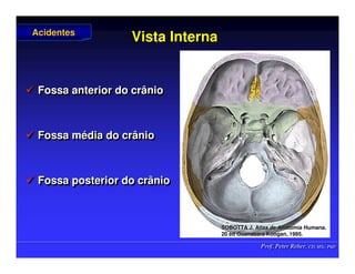 Prof. Peter Reher, CD, MSc, PhD
Prof. Peter Reher, CD, MSc, PhD
Vista Interna
Vista Interna
 Fossa anterior do crânio
 Fossa média do crânio
 Fossa posterior do crânio

 Fossa anterior do crânio
Fossa anterior do crânio

 Fossa m
Fossa mé
édia do crânio
dia do crânio

 Fossa posterior do crânio
Fossa posterior do crânio
Acidentes
Acidentes
SOBOTTA J. Atlas de Anatomia Humana.
SOBOTTA J. Atlas de Anatomia Humana.
20 ed Guanabara
20 ed Guanabara Koogan
Koogan, 1995
, 1995.
.
 