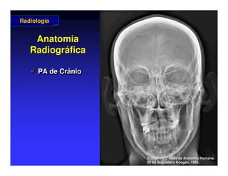 Anatomia
Anatomia
Radiogr
Radiográ
áfica
fica
 PA de Crânio

 PA de Crânio
PA de Crânio
Radiologia
Radiologia
SOBOTTA J. Atlas de Anatomia Humana.
SOBOTTA J. Atlas de Anatomia Humana.
20 ed Guanabara
20 ed Guanabara Koogan
Koogan, 1995
, 1995.
.
 