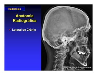 Anatomia
Anatomia
Radiogr
Radiográ
áfica
fica
 Lateral de Crânio

 Lateral de Crânio
Lateral de Crânio
Radiologia
Radiologia
SOBOTTA J. Atlas de Anatomia Humana.
SOBOTTA J. Atlas de Anatomia Humana.
20 ed Guanabara
20 ed Guanabara Koogan
Koogan, 1995
, 1995.
.
 