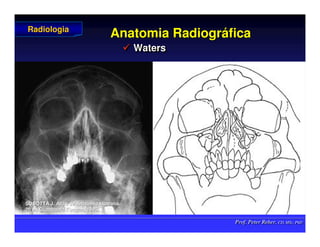 Prof. Peter Reher, CD, MSc, PhD
Prof. Peter Reher, CD, MSc, PhD
Anatomia Radiogr
Anatomia Radiográ
áfica
fica
 Waters

 Waters
Waters
Radiologia
Radiologia
SOBOTTA J. Atlas de Anatomia Humana.
SOBOTTA J. Atlas de Anatomia Humana.
20 ed Guanabara
20 ed Guanabara Koogan
Koogan, 1995
, 1995.
.
 