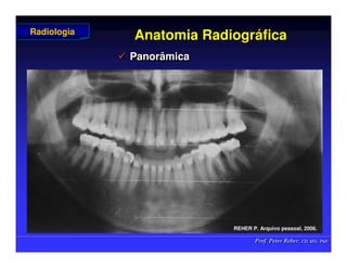 Prof. Peter Reher, CD, MSc, PhD
Prof. Peter Reher, CD, MSc, PhD
Anatomia Radiogr
Anatomia Radiográ
áfica
fica
 Panorâmica

 Panorâmica
Panorâmica
Radiologia
Radiologia
REHER P
REHER P.
. Arquivo
Arquivo pessoal
pessoal, 2006.
, 2006.
 
