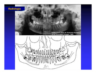 Radiologia
Radiologia
SOBOTTA J. Atlas de Anatomia Humana.
SOBOTTA J. Atlas de Anatomia Humana.
20 ed Guanabara
20 ed Guanabara Koogan
Koogan, 1995
, 1995.
.
 