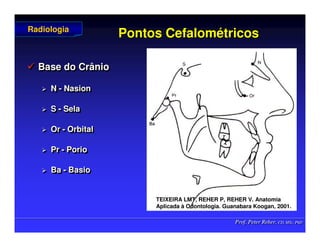 Prof. Peter Reher, CD, MSc, PhD
Prof. Peter Reher, CD, MSc, PhD
Pontos
Pontos Cefalom
Cefalomé
étricos
tricos
 Base do Crânio
 N - Nasion
 S - Sela
 Or - Orbital
 Pr - Porio
 Ba - Basio

 Base do Crânio
Base do Crânio

 N
N -
- Nasion
Nasion

 S
S -
- Sela
Sela

 Or
Or -
- Orbital
Orbital

 Pr
Pr -
- Porio
Porio

 Ba
Ba -
- Basio
Basio
Radiologia
Radiologia
TEIXEIRA LMT, REHER P, REHER V. Anatomia
TEIXEIRA LMT, REHER P, REHER V. Anatomia
Aplicada
Aplicada à
à Odontologia. Guanabara
Odontologia. Guanabara Koogan
Koogan, 2001
, 2001.
.
 