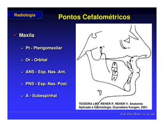 Prof. Peter Reher, CD, MSc, PhD
Prof. Peter Reher, CD, MSc, PhD
Pontos
Pontos Cefalom
Cefalomé
étricos
tricos
 Maxila
 Pt - Pterigomaxilar
 Or - Orbital
 ANS - Esp. Nas. Ant.
 PNS - Esp. Nas. Post.
 A - Subespinhal

 Maxila
Maxila

 Pt
Pt -
- Pterigomaxilar
Pterigomaxilar

 Or
Or -
- Orbital
Orbital

 ANS
ANS -
- Esp
Esp. Nas. Ant.
. Nas. Ant.

 PNS
PNS -
- Esp
Esp. Nas.
. Nas. Post
Post.
.

 A
A -
- Subespinhal
Subespinhal
Radiologia
Radiologia
TEIXEIRA LMT, REHER P, REHER V. Anatomia
TEIXEIRA LMT, REHER P, REHER V. Anatomia
Aplicada
Aplicada à
à Odontologia. Guanabara
Odontologia. Guanabara Koogan
Koogan, 2001
, 2001.
.
 