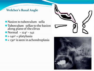 cranio-vertebralanomalies-overview-copy-151214131323 (1).pptx