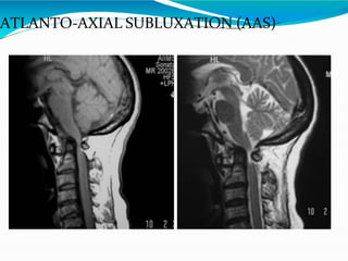 cranio-vertebralanomalies-overview-copy-151214131323 (1).pptx