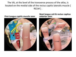 Lower clivus devided into
1. tubercular compartment [ Above red line ]
2. condylar compartment [ Below red line ]
Hypoglossal canal present at the junction of anterior 1/3rd & posterior 2/3rd
 