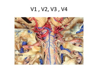 The occipital condyle (OC) is partially
drilled.
 