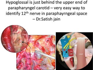 Lateral skull base view – observe the
petrous apex
 