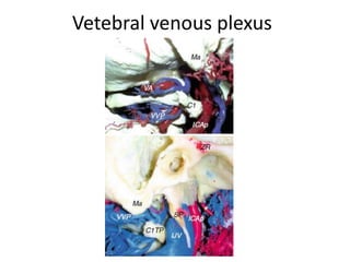 The VA, at the level of the transverse process of the atlas, is
located on the medial side of the rectus capitis lateralis muscle [
RCLM ] .
First Longus capitis muscle seen
Next longus coli & rectus capitus
anterior seen
 
