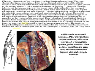 kinking or looping of the ICAp - when looping present para-pharyngeal carotid
comes to pre-styloid compartment – previously thought that para-pharyngeal
carotid never comes anterior to styloid mucles – which is UNTRUE
 
