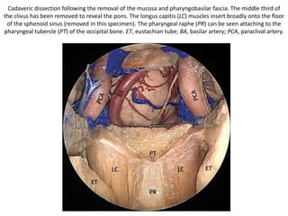 Lower cranial nerves sandwitched betweeb petrosal & bulb
components of jugular fossa - the pars nervosa is anterior to pars
venosa.. and the ica is the first structure u will encounter in the
anterior app
 