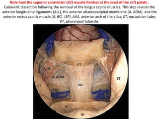 pars nervosa is
anterior to pars
venosa..
https://books.google.co
.in/books?id=e8gKUQg
eD24C&pg=PA634&lpg
=PA634&dq=pars+veno
sa&source=bl&ots=Sa
W2H-
2bR0&sig=lzevzuaK66D
T_Nj6PLfLH3orXQY&hl=
en&sa=X&ved=0CCsQ6
AEwAmoVChMIxqvJ1v2
bxwIVC9SOCh1-
pQ9s#v=onepage&q=p
ars%20venosa&f=false
 
