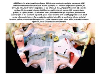 AAAM anterior atlanto-axial
membrane, AAOM anterior atlanto-
occipital membrane, white arrow
superior part of the cruciform
ligament , yellow arrow dura of the
posterior cranial fossa and upper
spine, white asterisk transverse
ligament, white circles tectorial
membrane
.
 