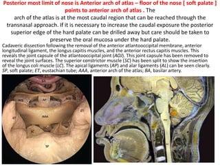 Note how the superior constrictor (SC) muscle finishes at the level of the soft palate .
Cadaveric dissection following the removal of the longus capitis muscles. This step reveals the
anterior longitudinal ligaments (ALL), the anterior atlantooccipital membrane (A. AOM), and the
anterior rectus capitis muscle (A. RC). (SP). AAA, anterior arch of the atlas; ET, eustachian tube;
PT, pharyngeal tubercle.
 