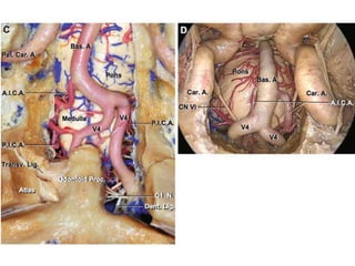 Tectorial membrane - posterior border of the supraodontoid
space.
 