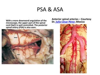 Transoral exposure of the craniocervical junction region. A. Mandibular bone and the tongue were excised. B. The soft palate
was excised and pharyngeal mucosa was retracted bilaterally and clivus was exposed. C. The clivus, atlas, and axis were exposed transorally.
D. Inferior third of the clivus, anterior arch of atlas, and the anterior part of the axis were excised down to level of the C3 vertebral
body and the dura was also excised correspondingly to demonstrate craniocervical junction region. aaa: anterior arch of atlas, aica:
anterior inferior cerebellar artery, asa: anterior spinal artery, at: atlas, ata: anterior tubercle of atlas, ax: axis, ba: basilar artery, C1: C-1
nerve root, C2: C-2 nerve root, cl: clivus, d: dens, du:dura, hp: hard palate, iaf-at: inferior articular facet of atlas, lcap: longus capitis
muscle, ma: mandible, mo: medulla oblangata, mu: pharyngeal mucosa, pns: posterior nasal spine of palatine bone, pt: palatine tonsil,
saf-ax: superior articular facet of axis, sc: spinal cord, sp: soft palate, u: uvula, V4: intradural segment of vertebral artery, vo: vomer.
 