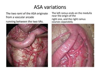 Note the transverse ligament & tectorial membrance in both
photos
Cadaveric dissection following the removal of the
apical and alar ligaments, and the odontoid
process has been drilled away (OP). This reveals
the strong and thick transverse portion of the
cruciform ligament (CL). Behind this is located the
tectorial membrane (TM). ET, eustachian tube; SP,
soft palate; HC, hypoglossal canal; VA, vertebral
artery; BA, basilar artery.
AAAM anterior atlanto-axial membrane, AAOM
anterior atlanto-occipital membrane, white arrow
superior part of the cruciform ligament , yellow
arrow dura of the posterior cranial fossa and
upper spine, white asterisk transverse ligament,
white circles tectorial membrane
.
 