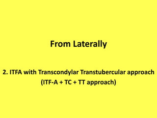 ASA variations
Only one ramus gives origin to
the ASA.
Both the right and left rami have
a separate course.
 