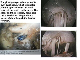 Extreme lateral extension [ Far-lateral – Transcondylar ]
approach
AFL anterior foramen lacerum , C1 atlas , CO cochlea , ICA internal carotid artery , IJV internal
jugular vein , Lv vein of Labbé , M mandible , mma middle meningeal artery
OC occipital condyle , pc clinoid process , pp pterygoid plate , sph sphenoid sinus , sps superior
petrosal sinus , TA transverse process of the atlas , TS transverse sinus , V2 maxillary branch of
the trigeminal nerve , V3 mandibular branch of the trigeminal nerve , za zygomatic arch , VA
vertebral artery , VII facial nerve , IX glossopharyngeal nerve , XI spinal accessory nerve , XII
hypoglossal nerve
Far-lateral approach further extends
posteroinferolateral exposure
Schematic illustration of the
extreme lateral approach (ELA)
 