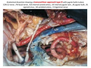 OC= Occipital condyle , JT = Jugular tubercle ,
JP = Jugular process
 