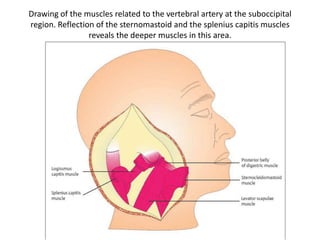Intradural structures when
approached laterally by
ITF-A + TC + TT approach
 