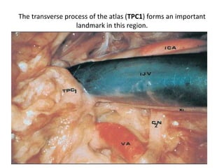 From Laterally
Far lateral or Transcondylar approach
 