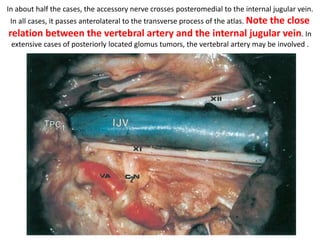Between suprior oblique SO &
inferior oblique IO you will find the
vertebral artery – Dr.Satish jain
 