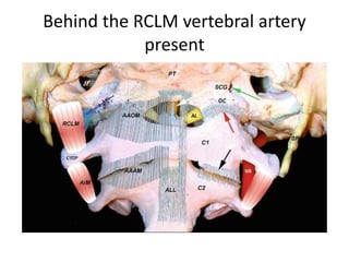 Just adding two triangles of petrous bone base around foramen magnum ,
your lower clivus / foramen magnum area completes -- just as simple as that
 