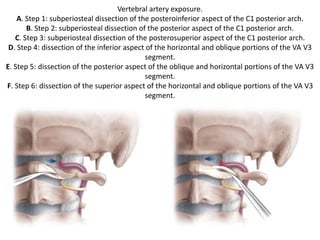 In about half the cases, the accessory nerve crosses posteromedial to the internal jugular vein.
In all cases, it passes anterolateral to the transverse process of the atlas. Note the close
relation between the vertebral artery and the internal jugular vein. In
extensive cases of posteriorly located glomus tumors, the vertebral artery may be involved .
 