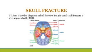 SKULL FRACTURE
CT Scan is used to diagnose a skull fracture. But the basal skull fracture is
well appreciated by MRI.
 