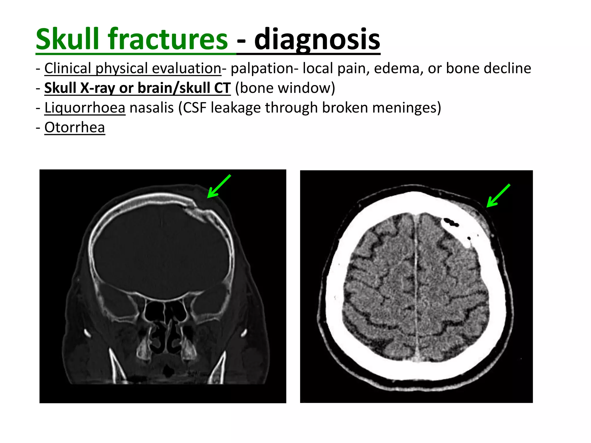 Window Edem Craniocerebral Injury.ppt