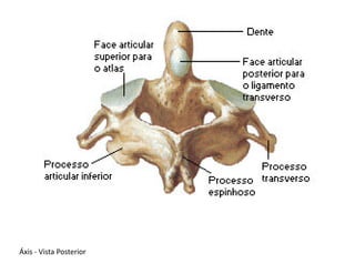 Áxis - Vista Posterior
 