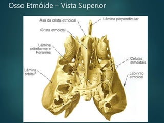 Osso Etmóide – Vista Superior
 