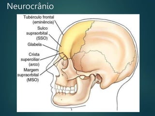 Neurocrânio
 