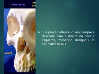  Sua porção interior, quase sempre é
desviada para a direita ou para a
esquerda, tornando desiguais as
cavidades nasais.
 