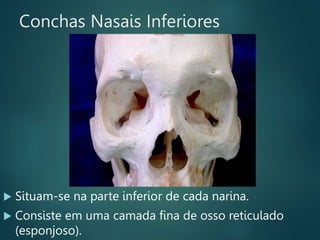 Conchas Nasais Inferiores
 Situam-se na parte inferior de cada narina.
 Consiste em uma camada fina de osso reticulado
(esponjoso).
 